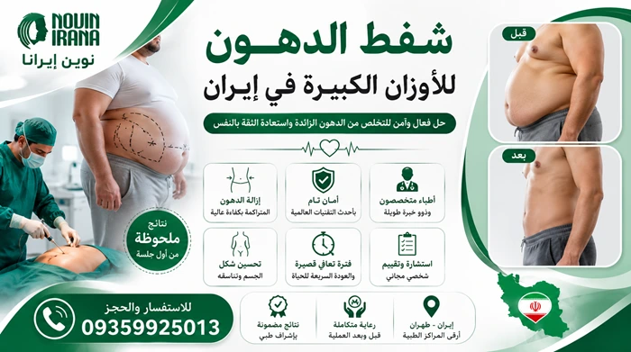 شفط الدهون للأوزان الكبيرة في إيران
